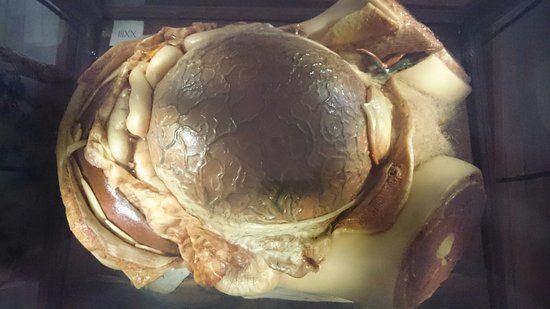 Clemente Susini's wax anatomical models